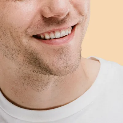 The invisible orthodontist man